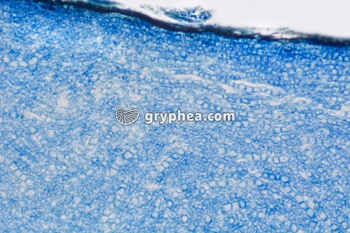 Ergot de Seigle x100b_1 - gryphea.com